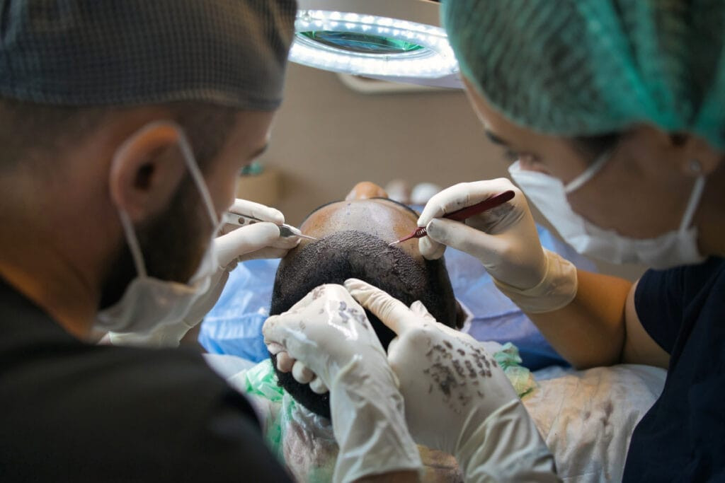 Surgeons performing a hair transplant procedure