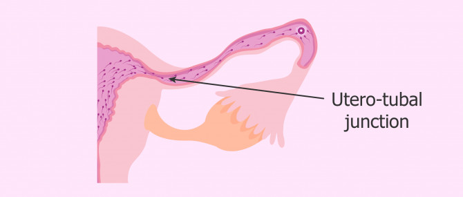 Sperm transport through the uterotubal junction